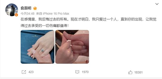 烧伤重生后遇真爱，俞灏明王晓晨结婚！汇总两人恋爱历程
